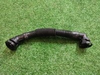 Вентиляционная трубка