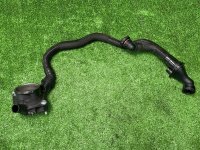 Вентиляционная трубка